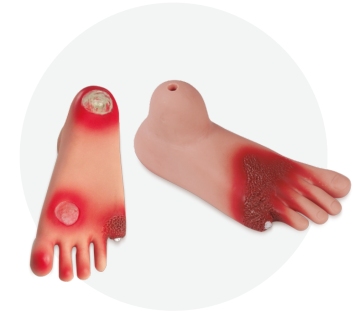 Diabetic Foot Anatomy Model