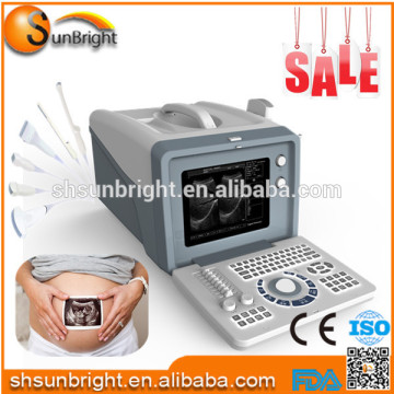 cheap ultrasound/ultrasonic/ultrasound scanner