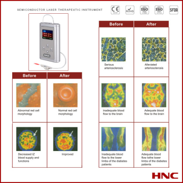 Diabetes Therapy / Coronary Heart Disease Treatments (HY-05AN)