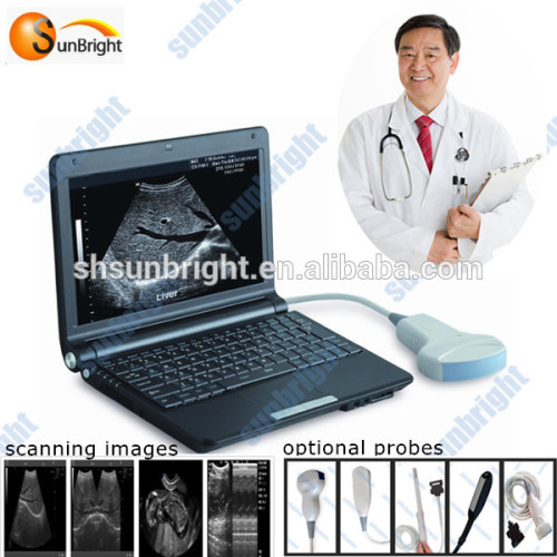 Gain-control ultrasound B-scan