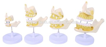 Tooth development model