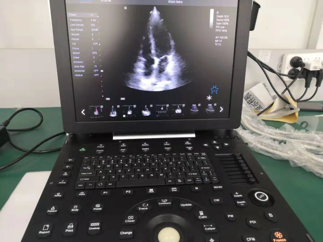 4D Color Ultrasound Doppler Probe Machine