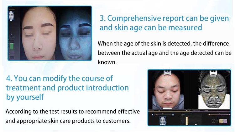 Facial Skin Analyzer