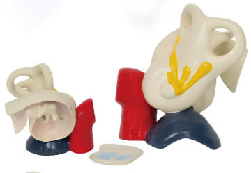 Anatomical magnification of the middle ear