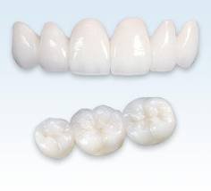 Not Easy To Break  Dental Zirconia Crowns Dental Laboratory For Metal Free Esthetics