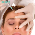 Gel Filler Remove Deep Wrinkles on Neck