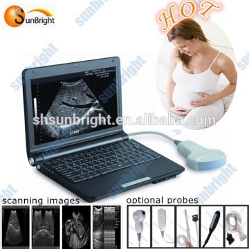 for pregnancy dignostic ultrasound