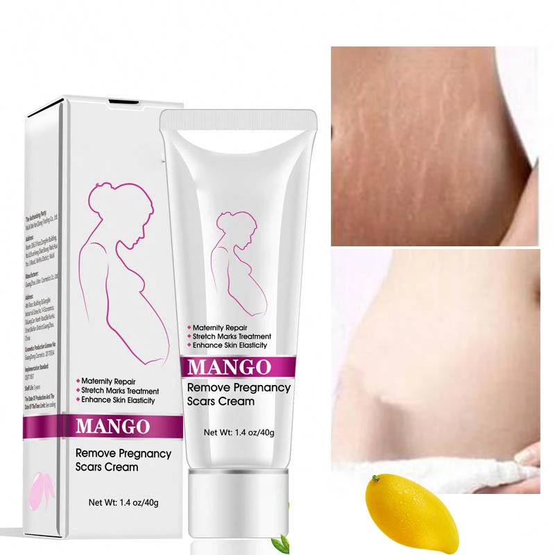 Wholesale High Quality Clean & Clear Body Care for Belly Stretch Mark Anti Pimples Removal Cream Ice Body Cream