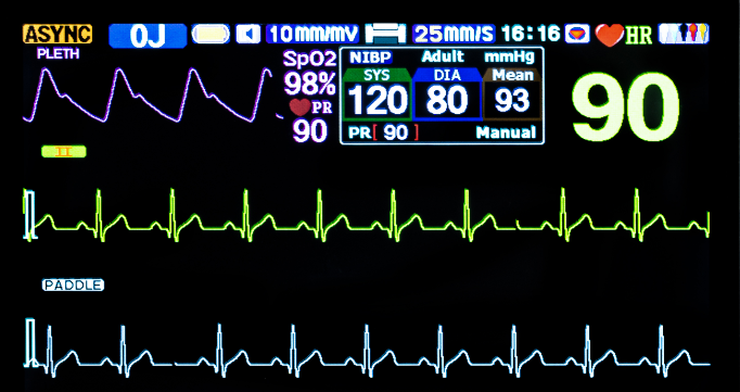 BT-8000C急救设备紧急救护设备医用便携式除颤器双相除颤器监护仪价格