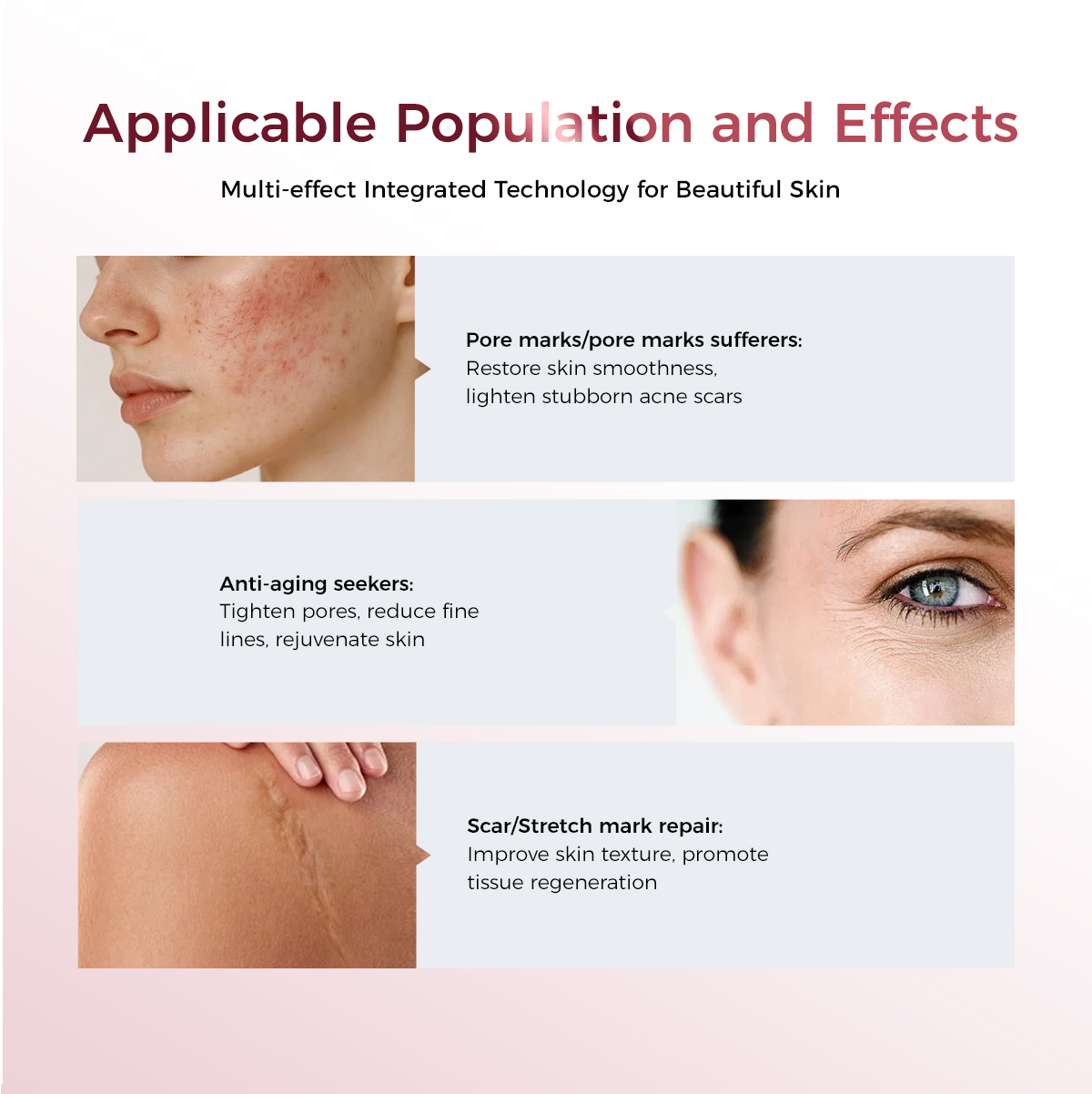 laser para redução de cicatrizes scar reduction laser