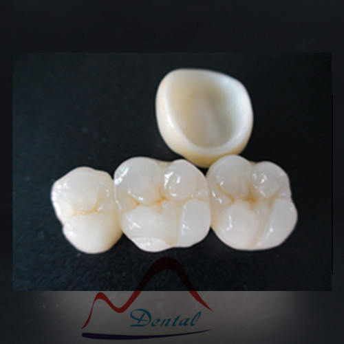 Full zirconia  (4)