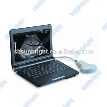 ultrasound scanner portable laptop & laptop ultrasound machine