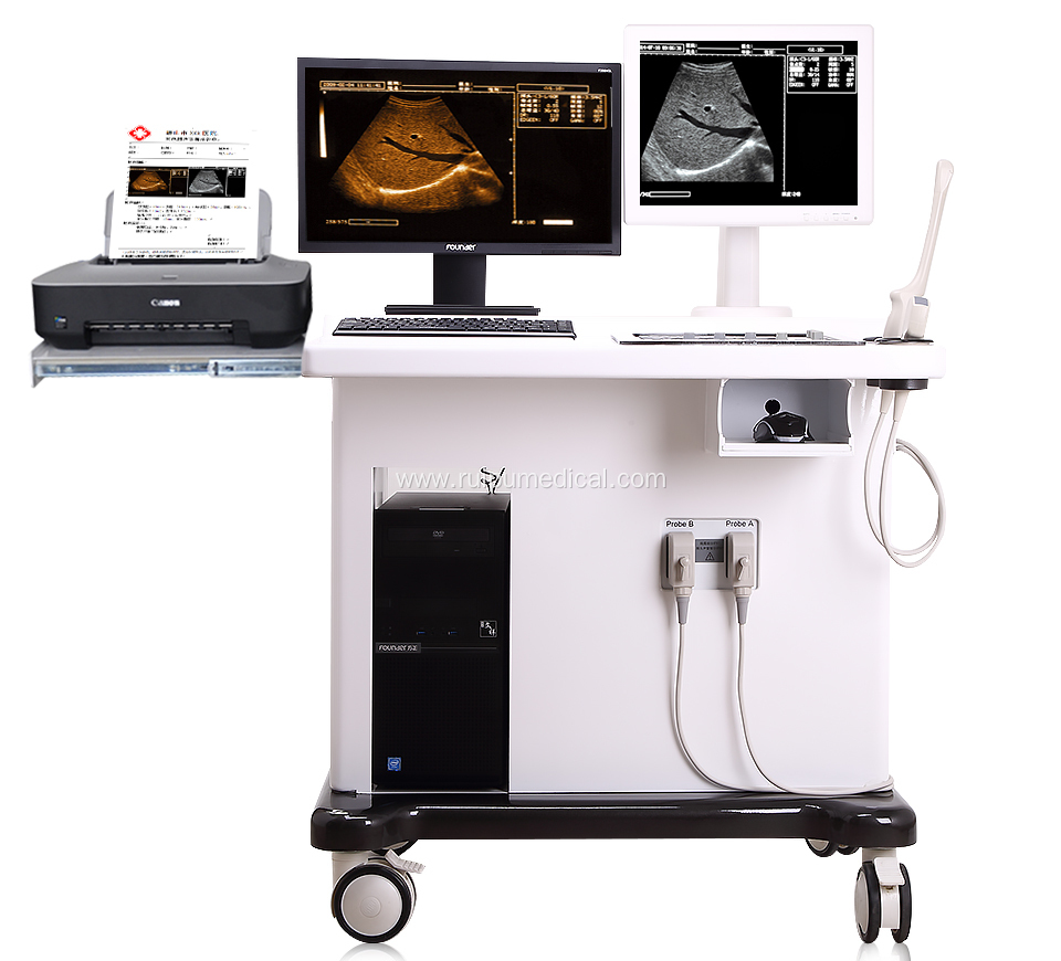 Hospital Digital Trolley Ultrasound Machine with Workstation