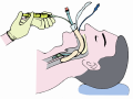 의료 일회용 무균 Tracheostomy 세트 CE 승인