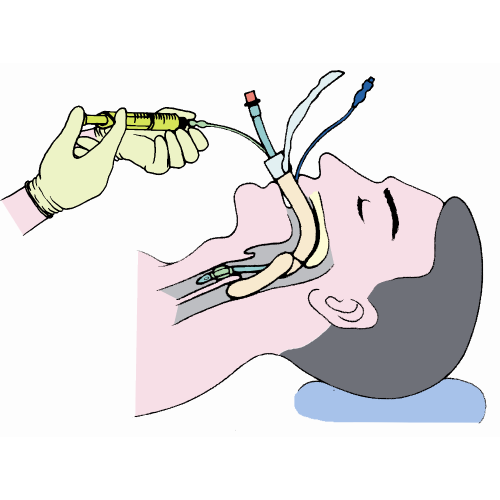 High Quality Tracheostomy Set