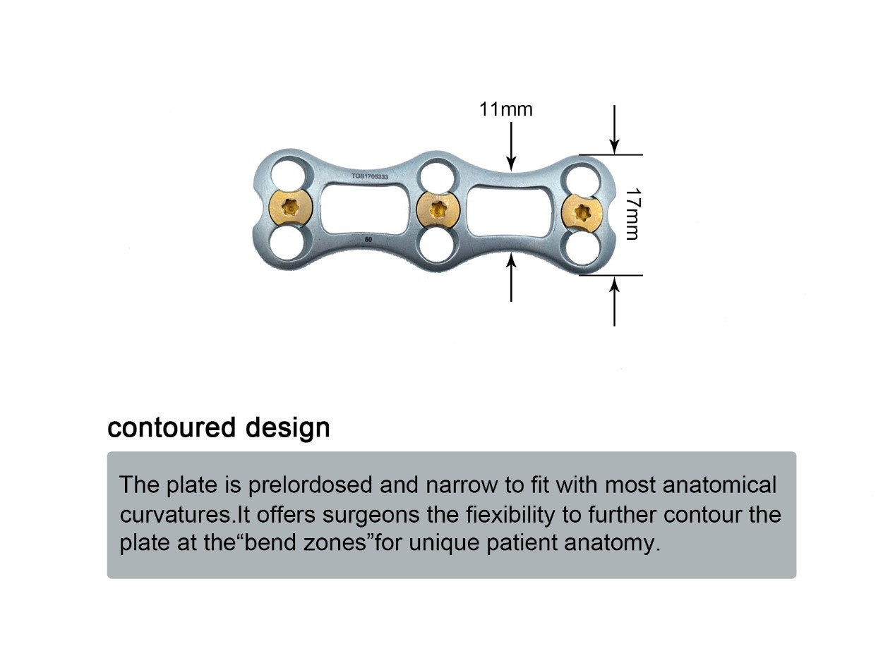 Spine Implant Anterior Cervical Plate & Orthopedic Devices, High ...