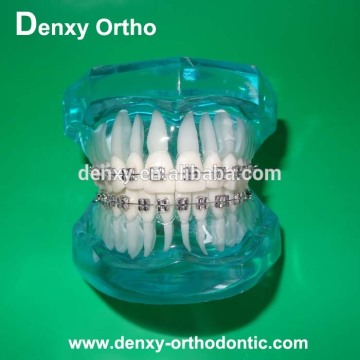 orthodontic teeth model beautiful blue orthodontic dental model