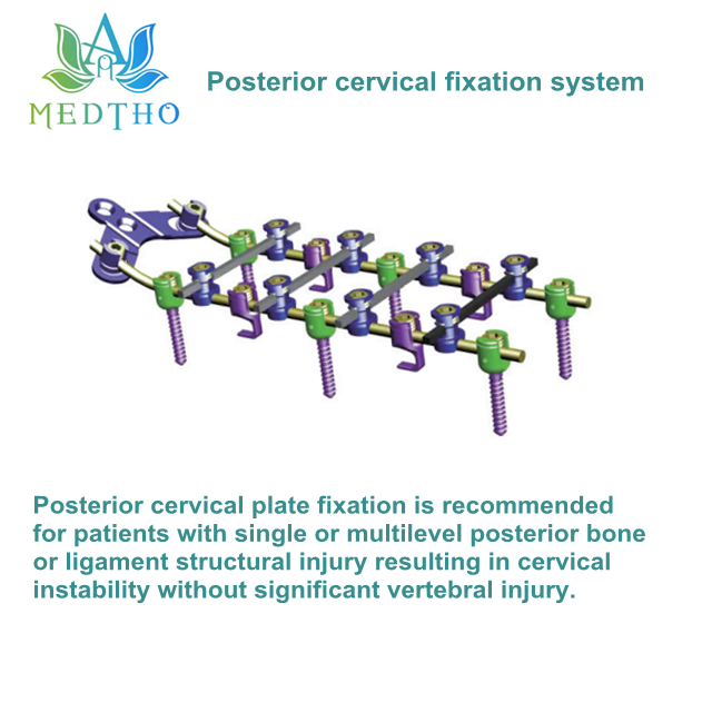 spine fixation spine fixation