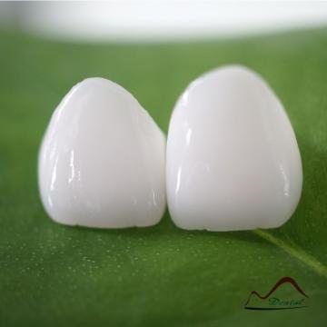 Dental Incisor Emax Crowns