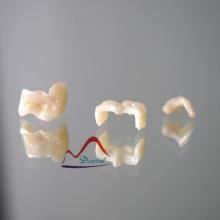 CAD/CAM Contour Zirconia Inlay