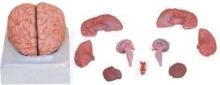 Brain With Arteries Model