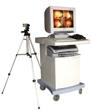 Electronic Colposcope