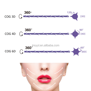 Fio PCL 3D 4D 6D 21G 60MM PCL Threads Korea PCL PDO Theads