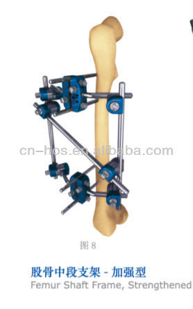 Femur Strengthened orthopedic external fixation