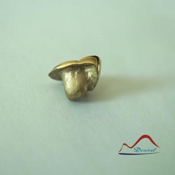 DENTAL Molar Gold Onlay