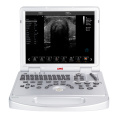 UW-L5 แล็ปท็อปสแกนเนอร์สี Doppler Ultrasound