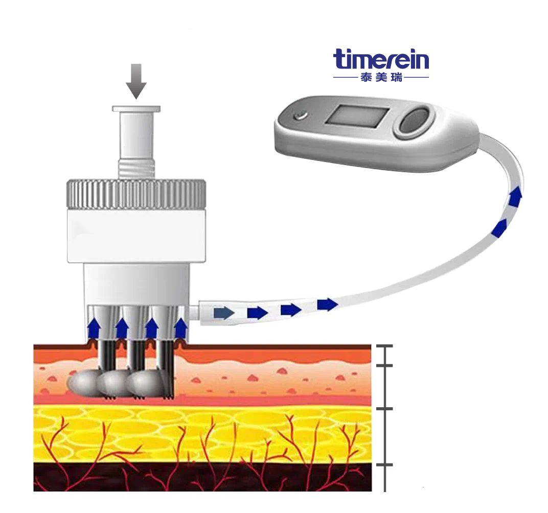 Hidrasyon enjeksiyonu Hydration Injection