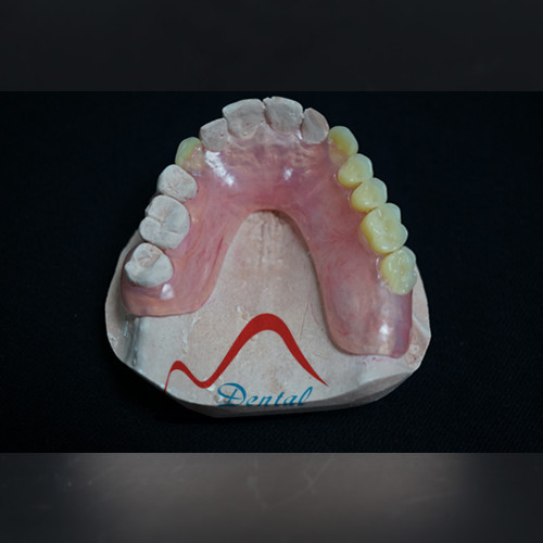 Dental Valplast Partial Denture