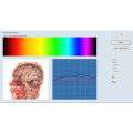 bioresonantie aura-analysator diagnostische machine