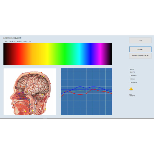 oberonvektor V16 nls bioresonans terapimaskin