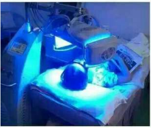 Choicy LED Light Therapy 보호 안전 고글