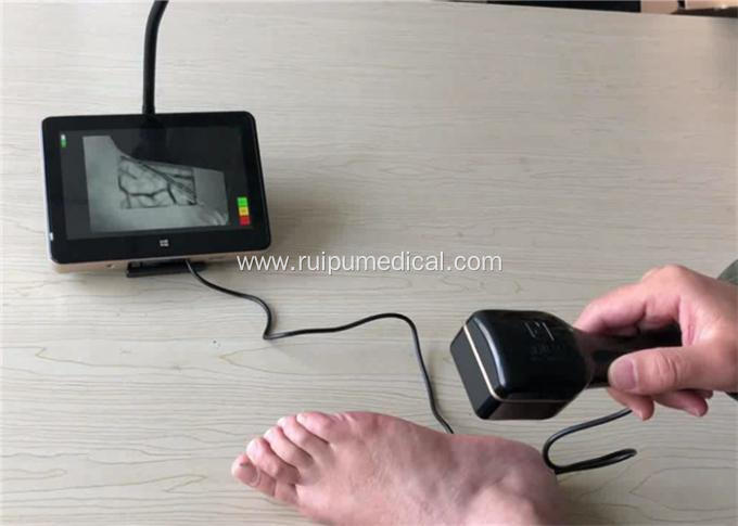 Tablet Medical Infrared Vein Finder With Touch Screen