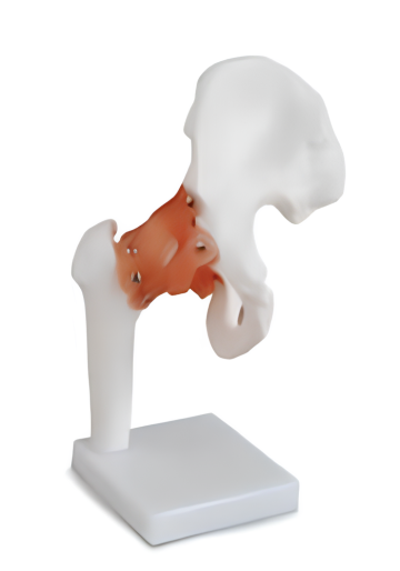 Life-Size Hip Joint Anatomy Model