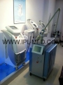 q-switch nd yag laser della pelle cura macchina