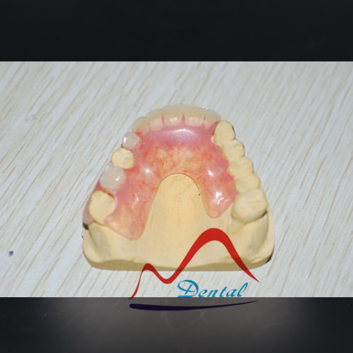 Valplast denture  (2)