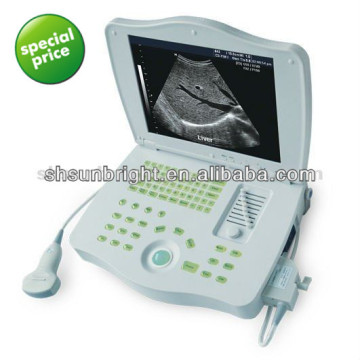 portable lcd ultrasound scanner