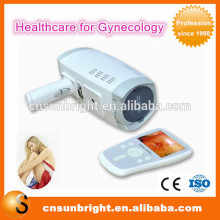 CE approved Handheld digital colposcope mini colposcope