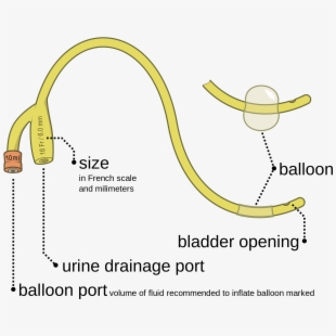 Bilateral foley catheter