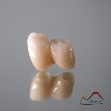 CAD/CAM Zirconia implant Bridge