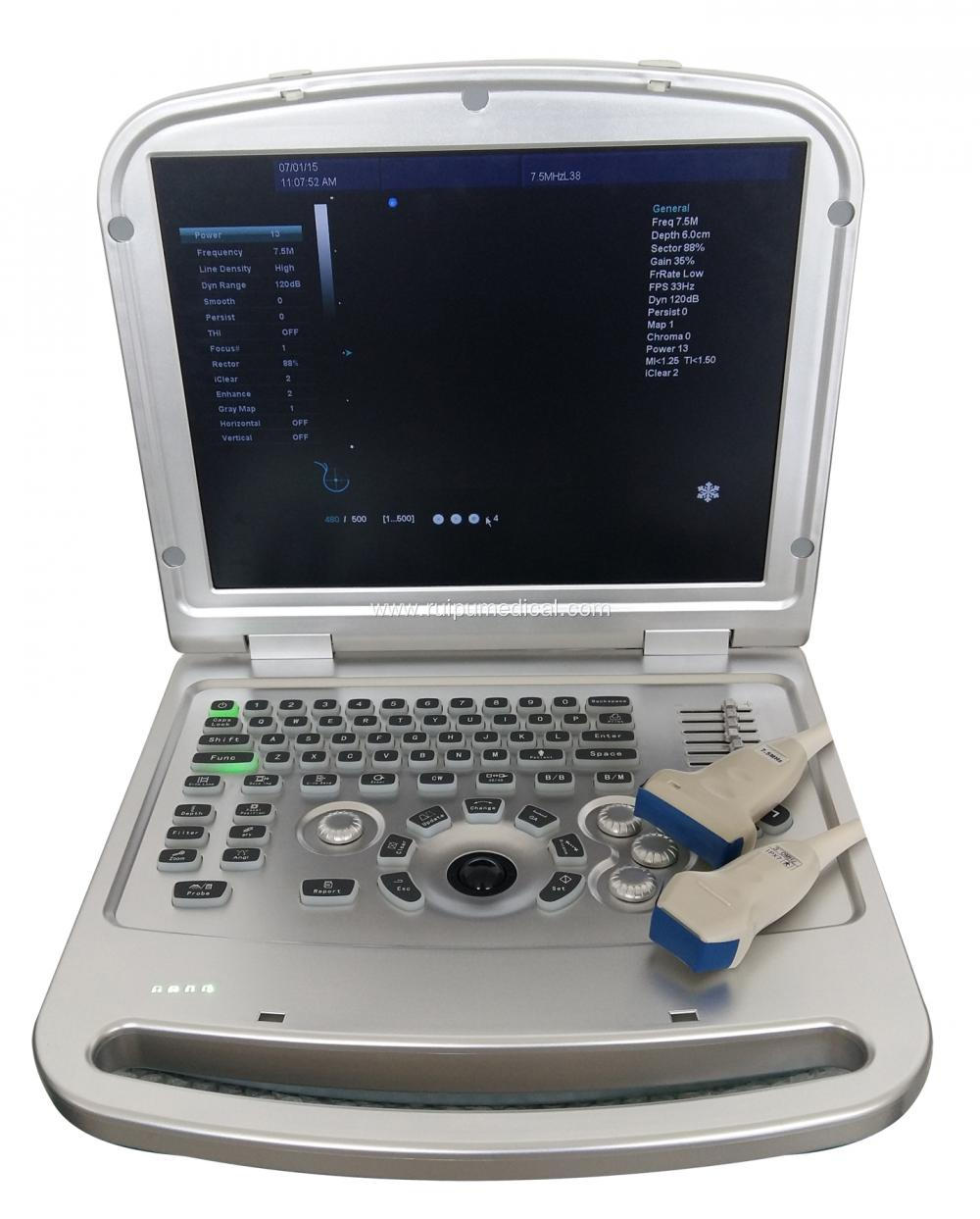 High Quality Laptop 4d Portable Color Doppler Ultrasound Machine