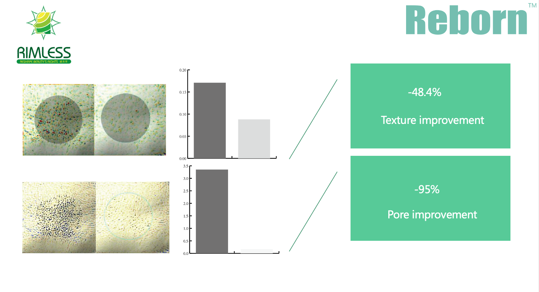 2ml 5ml Reborn plla hydrogel for removing the melanin in the body