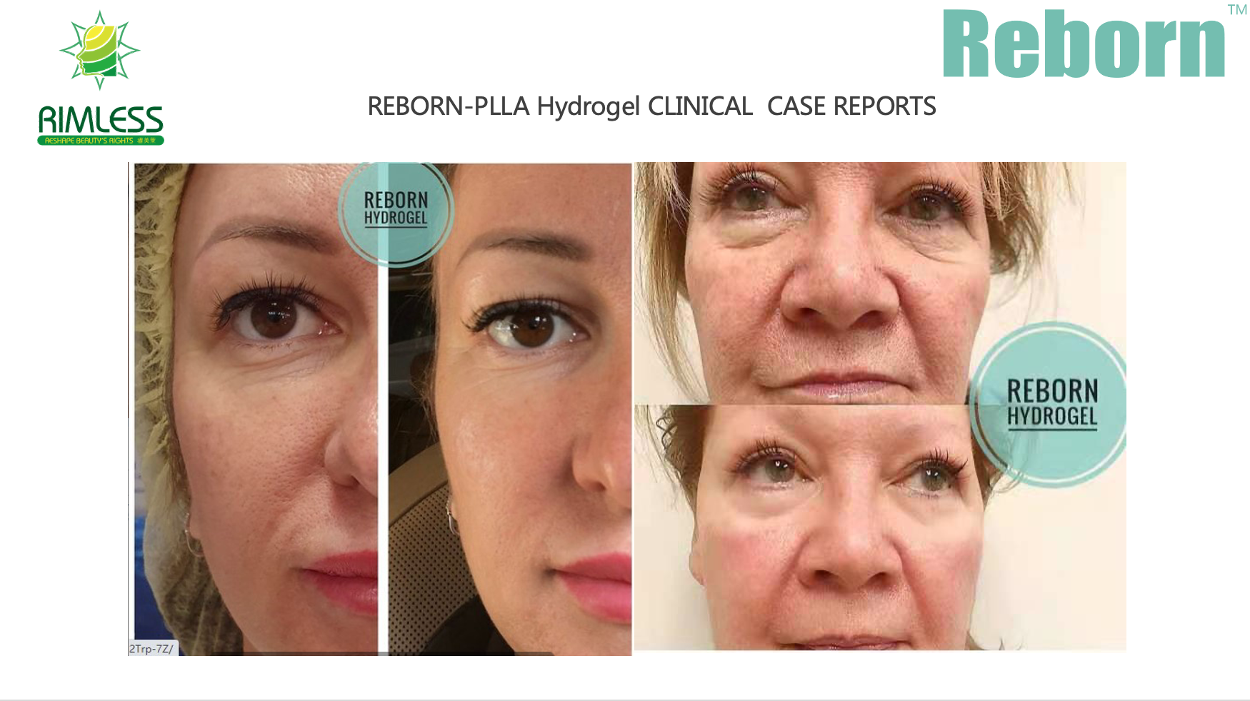 Reborn PLLA Cosmetic Gel For Face - Plumps & Hydrates