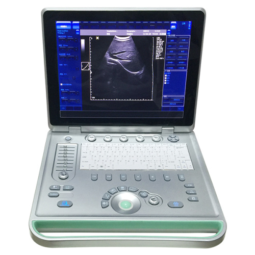 C5PRO Tragbare Laptop-Farbdoppler-Ultraschallmaschine