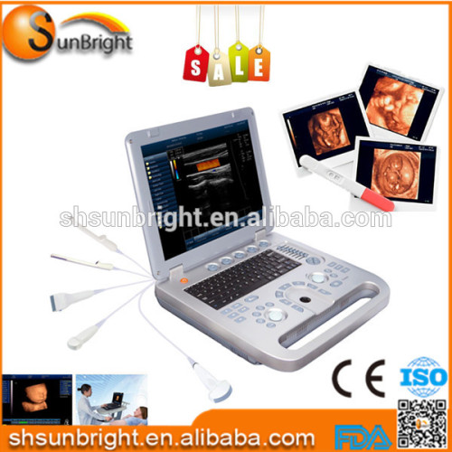 3D Full Digital Color Doppler diagnostic Ultrasound System Ultrasound printer