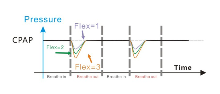 Special pressure relief technology