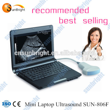 mini USB laptop /Portable Ultrasound scanner / USB ultrasound machine